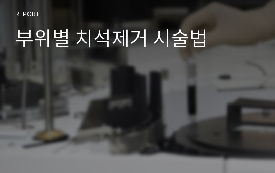 부위별 치석제거 시술법