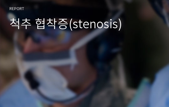 척추 협착증(stenosis)