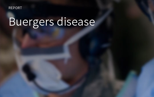 Buergers disease