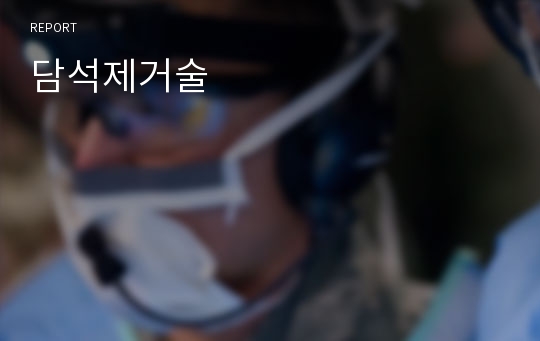 담석제거술