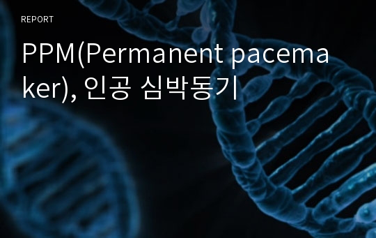 PPM(Permanent pacemaker), 인공 심박동기