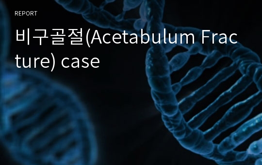 비구골절(Acetabulum Fracture) case