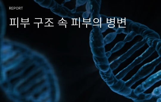 피부 구조 속 피부의 병변