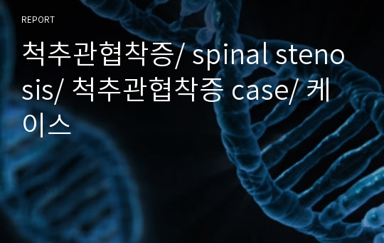 척추관협착증/ spinal stenosis/ 척추관협착증 case/ 케이스