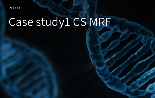 Case study1 CS MRF