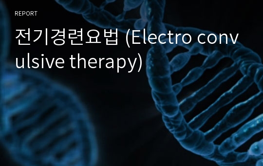 전기경련요법 (Electro convulsive therapy)