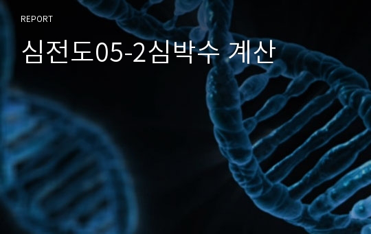 심전도05-2심박수 계산