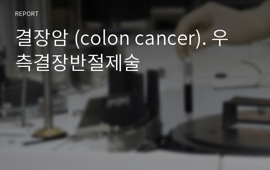 결장암 (colon cancer). 우측결장반절제술