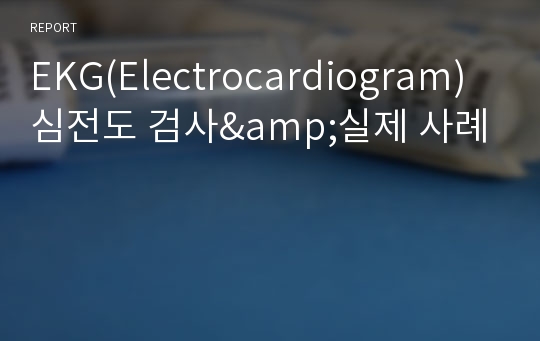 EKG(Electrocardiogram) 심전도 검사&amp;실제 사례