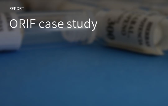 ORIF case study