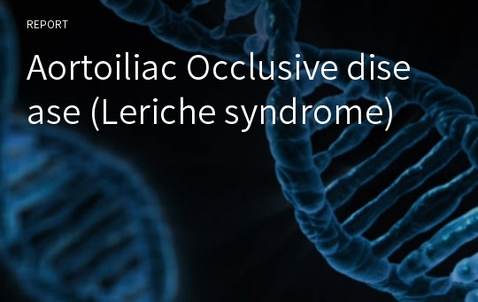 Aortoiliac Occlusive disease (Leriche syndrome)