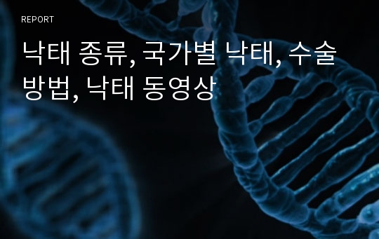 낙태 종류, 국가별 낙태, 수술방법, 낙태 동영상