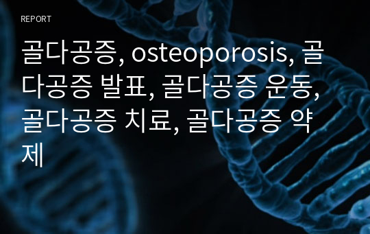 골다공증, osteoporosis, 골다공증 발표, 골다공증 운동, 골다공증 치료, 골다공증 약제