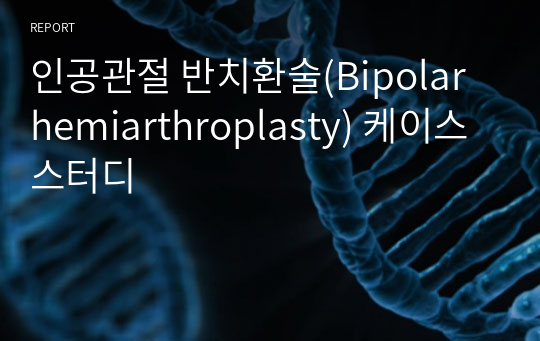 인공관절 반치환술(Bipolar hemiarthroplasty) 케이스 스터디