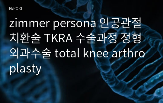 zimmer persona 인공관절치환술 TKRA 수술과정 정형외과수술 total knee arthroplasty