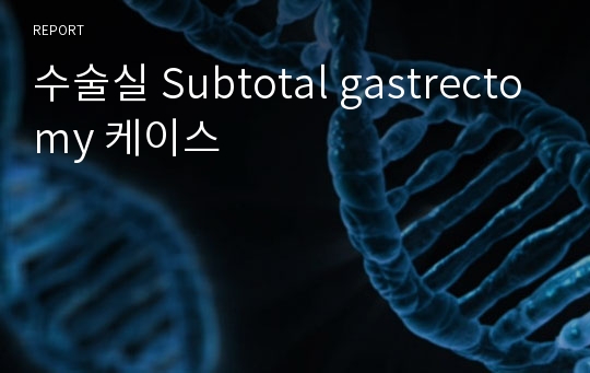 수술실 Subtotal gastrectomy 케이스