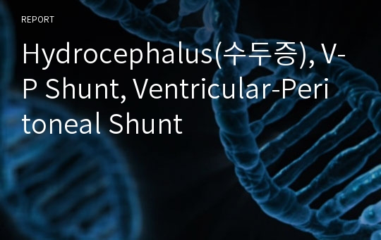 Hydrocephalus(수두증), V-P Shunt, Ventricular-Peritoneal Shunt