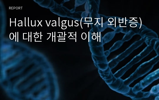 Hallux valgus(무지 외반증)에 대한 개괄적 이해