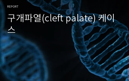 구개파열(cleft palate) 케이스