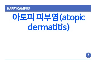 아토피 피부염(atopic dermatitis)