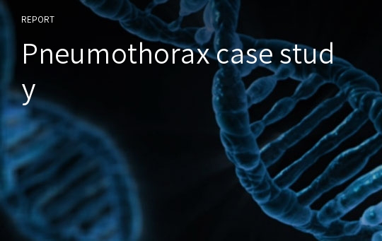 Pneumothorax case study