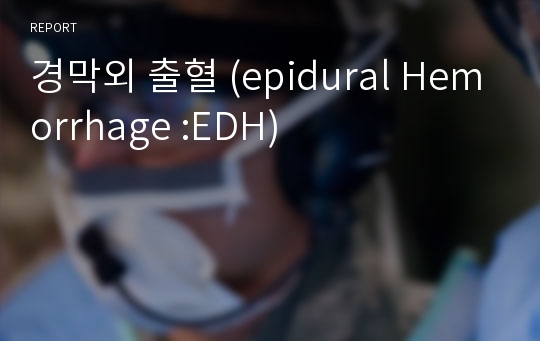 경막외 출혈 (epidural Hemorrhage :EDH)