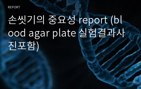 손씻기의 중요성 report (blood agar plate 실험결과사진포함)