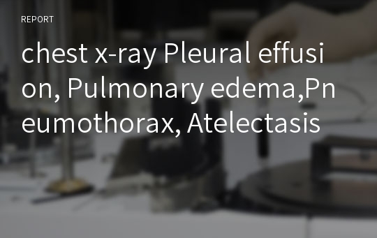 chest x-ray Pleural effusion, Pulmonary edema,Pneumothorax, Atelectasis