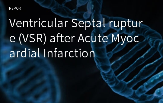 Ventricular Septal rupture (VSR) after Acute Myocardial Infarction