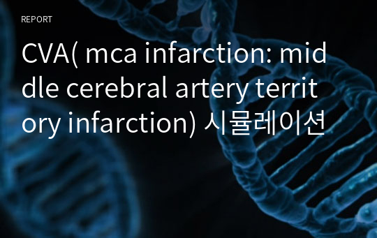 뇌졸중 CVA( mca infarction: middle cerebral artery territory infarction) 시뮬레이션