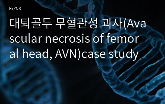 대퇴골두 무혈관성 괴사(Avascular necrosis of femoral head, AVN)case study