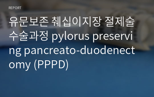 유문보존 췌십이지장 절제술 수술과정 pylorus preserving pancreato-duodenectomy (PPPD)