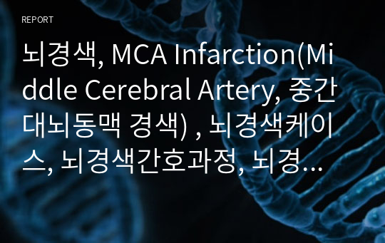 뇌경색, MCA Infarction(Middle Cerebral Artery, 중간대뇌동맥 경색) , 뇌경색케이스, 뇌경색간호과정, 뇌경색재활의학과, 재활간호과정, 재활케이스