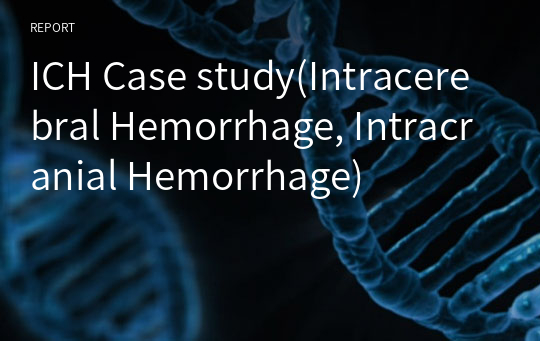 ICH Case study(Intracerebral Hemorrhage, Intracranial Hemorrhage)