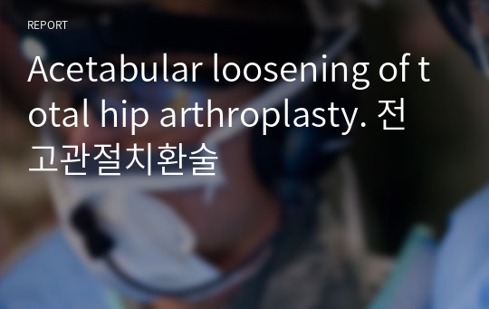 Acetabular loosening of total hip arthroplasty. 전고관절치환술