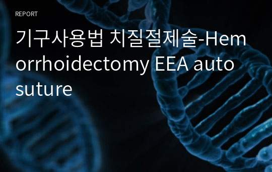 기구사용법 치질절제술-Hemorrhoidectomy EEA auto suture
