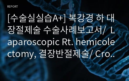 [수술실실습A+] 복강경 하 대장절제술 수술사례보고서/  Laparoscopic Rt. hemicolectomy, 결장반절제술/ Crohn&#039;s disease, 크론병/ 수술간호/ 수술절차, 수술과정/ 수술 전, 중, 후 간호/ 수술기구 및 장비/ OR 실습