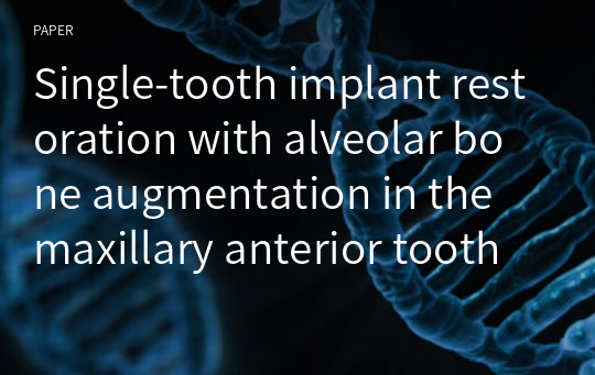 Single-tooth implant restoration with alveolar bone augmentation in the maxillary anterior tooth region: a case report