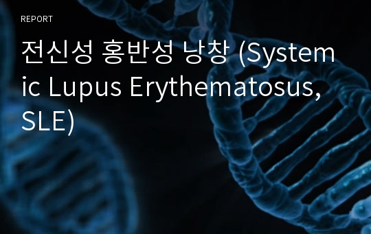 전신성 홍반성 낭창 (Systemic Lupus Erythematosus, SLE)