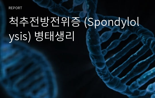 척추전방전위증 (Spondylolysis) 병태생리