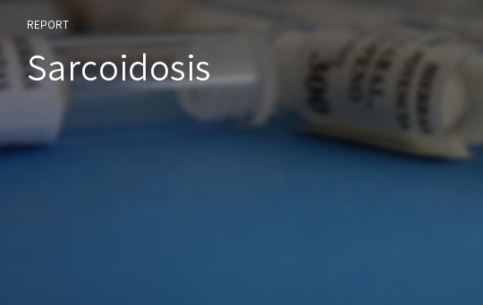 Sarcoidosis