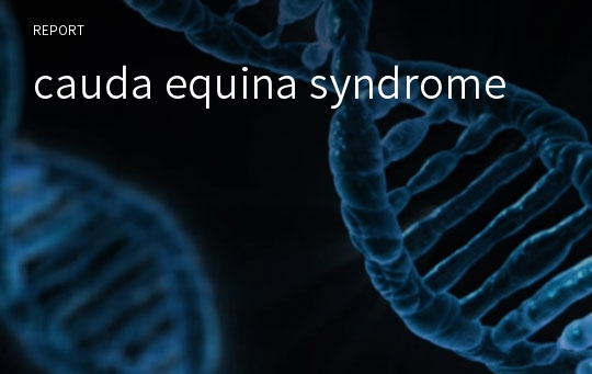 cauda equina syndrome