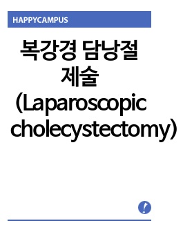 복강경 담낭절제술 (Laparoscopic cholecystectomy) 수술실 케이스